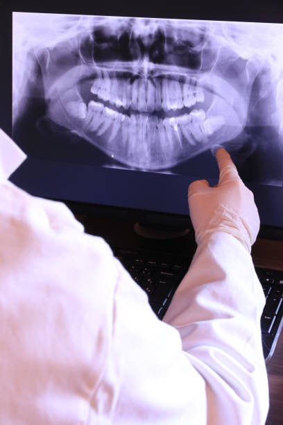 Best Emergency Denture Repair in Mcarthur, OH